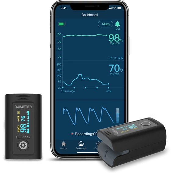 Viatom Oxísmart Bluetooth pulzoximéter